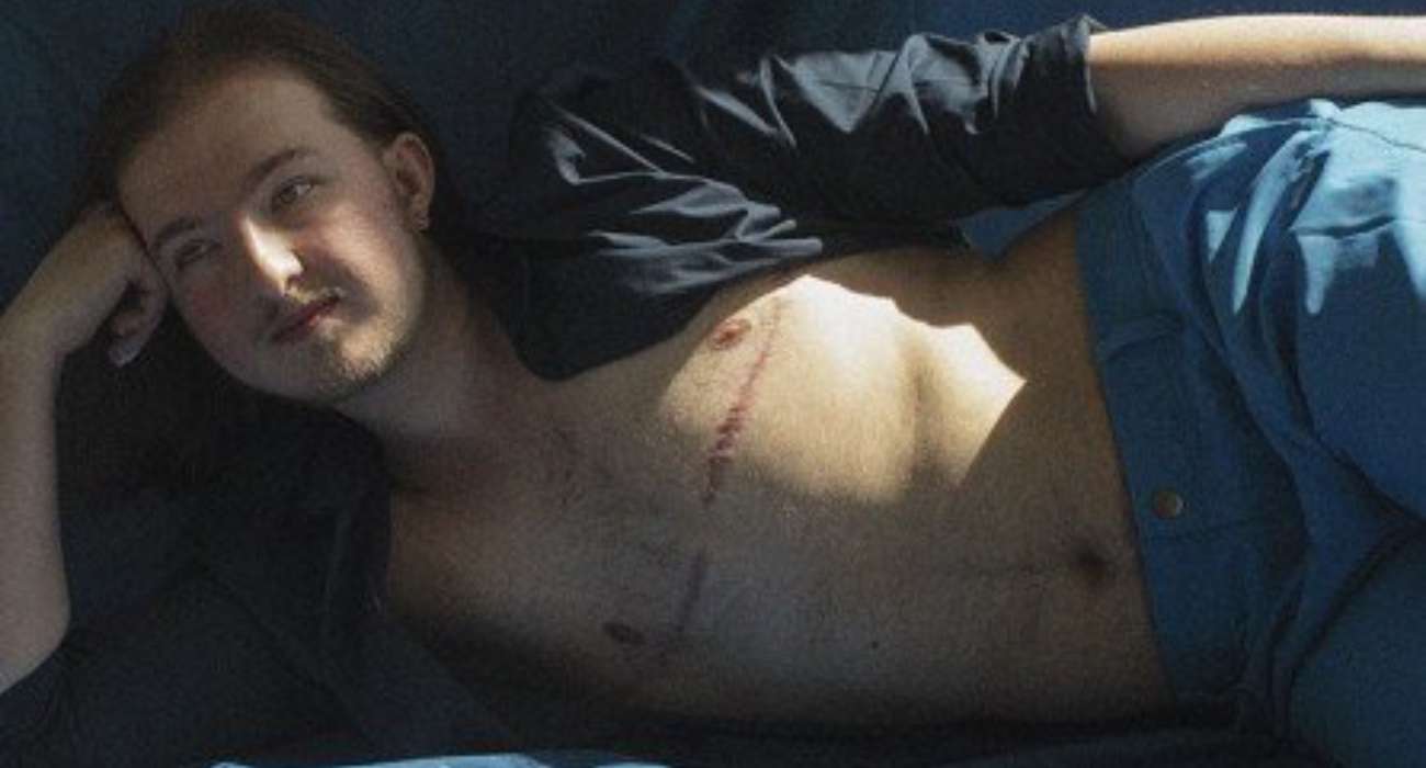 Na pierwszym planie ma być człowiek, nie blizny - wystawa fotografki mody Pameli Porwen "Blizny Dumy"