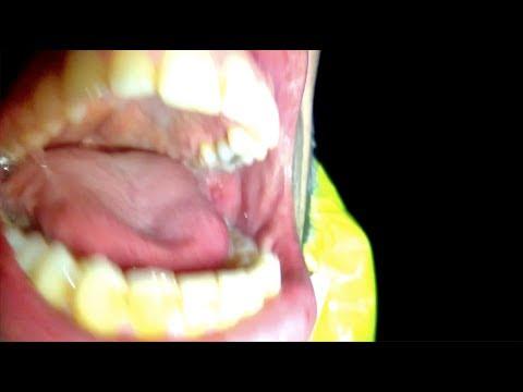 Miniatura wideo YouTube