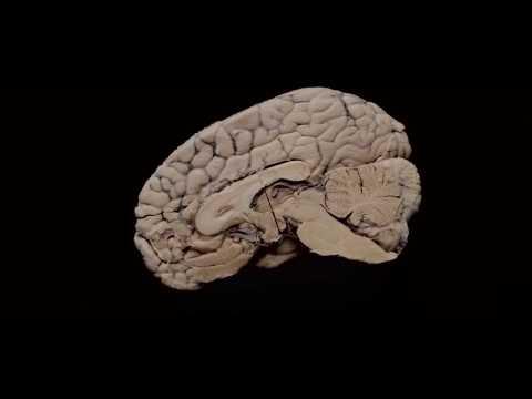 Miniatura wideo YouTube