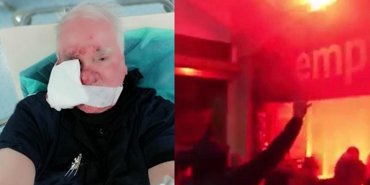 Zebraliśmy filmiki i relacje z Marszu Niepodległości. Bitwa o Empik i poszkodowani dziennikarze