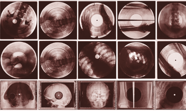 Muzyka kości, czyli jak przemycano piosenki zakazane