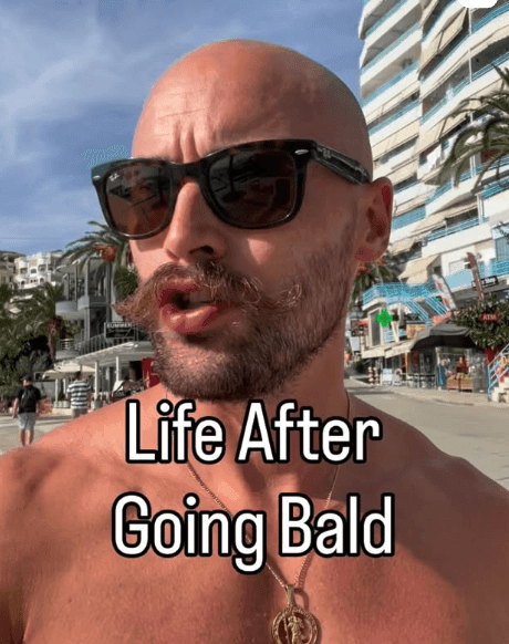 Zamiast bać się łysienia, chwalą się gładką głową. Czym jest „baldmaxxing”?