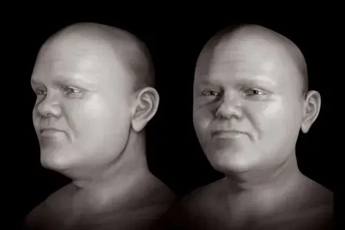 Średniowieczny Polak cierpiał na 2 choroby genetyczne. Zbadano stary szkielet z Łekna